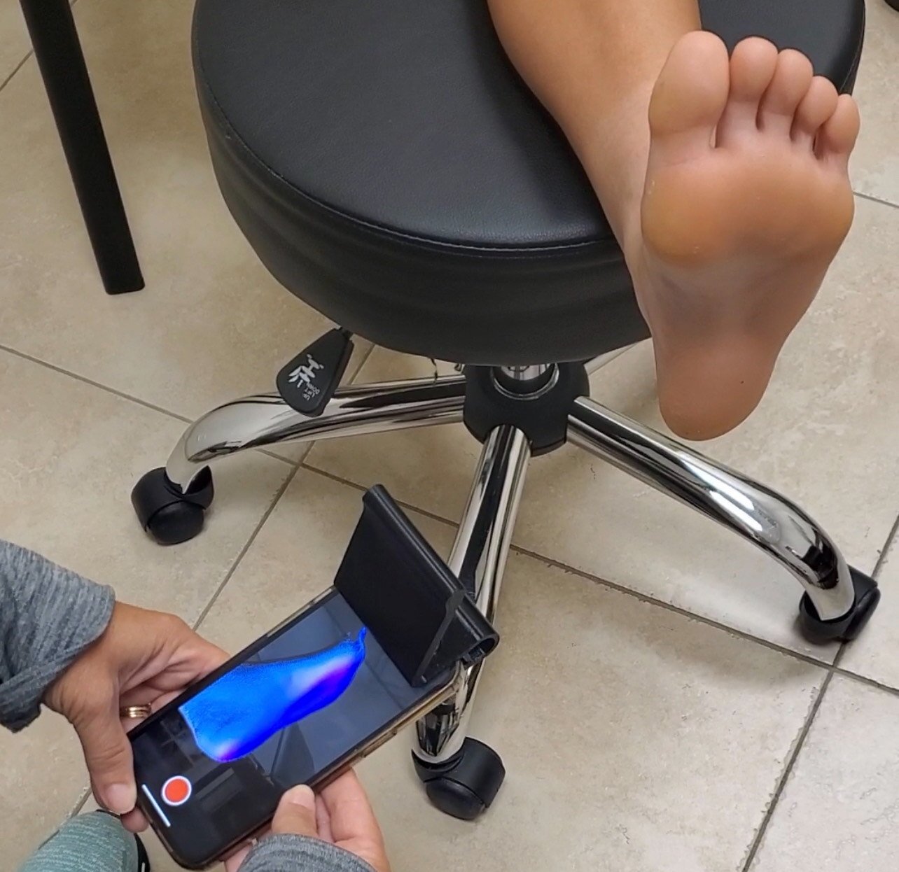 3D scan and printed foot orthotics