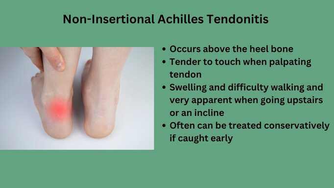 noninsertionalachilles-1